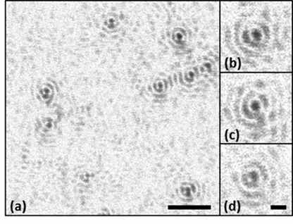 Microsphere OCT image