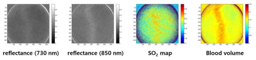 산소포화도 측정을 위한 multispectral images
