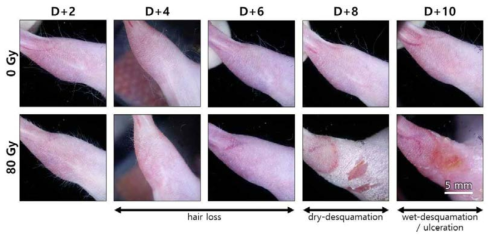 정상 및 방사선 피부 손상 마우스의 (80 Gy) dermoscopy 영상