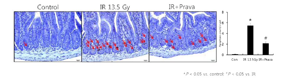 방사선 위장관 손상에 대한 pravastatin 효과 : Anti-apoptotic effects