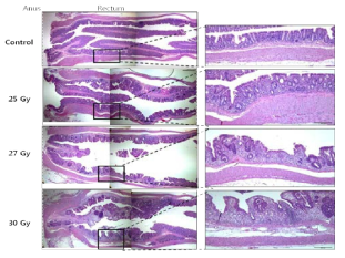 방사선 직장염 2주차 조직학적 평가
