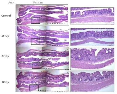 방사선 직장염 4주차 조직학적 변화