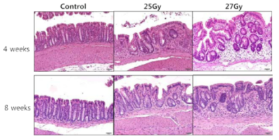 방사선 직장염 모델에서의 조직학적 변화