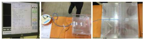 Experimental setup for correction of calculated RTP result with a solid water phantom and dosimeter