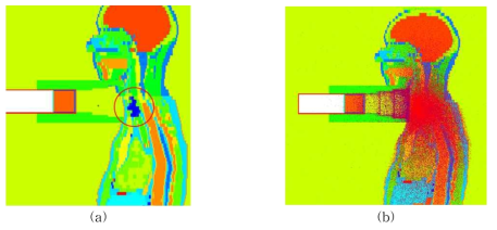 Simulation geometry with NCI/UF hybrid phantom in thyroid internal contamination monitoring (a) Source, (b) Particle tracking