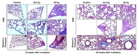 Analysis of lung fibrosis in mice by ionizing radiation