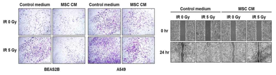 Inhibition of migration in lung cells by secretion factor from MSC