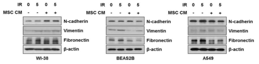 Inhibition of EMT in lung cells by secretion factor from MSC