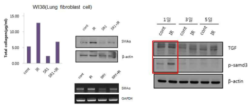 StemRegenin 1 (SR1) inhibits lung fibrosis by ionizing radiation and TGF β