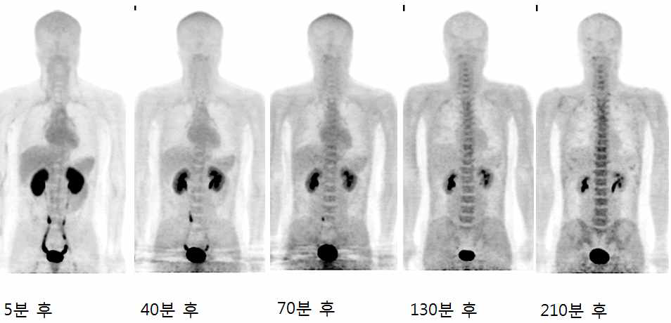 정상인에서 각 시간대별로 획득한 전신 18F-FMT PET영상