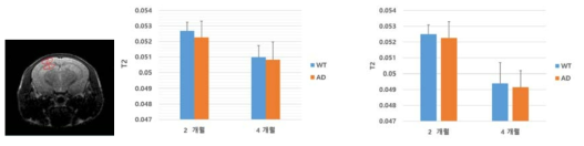 T2WI 에서 관심영역 설정 (좌); Hippocampus (1) 와 Cortex (2) 관심영역 설정, Hippocampus 에서의 T2 값 비교 (중간), Cortex 에서의 T2 값 비교 (우)