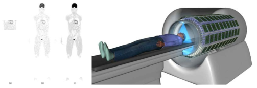 좌: PET/CT 스캐너를 이용한 성인 남성 팬텀 영상화(a) 임상 PET/CT single bed scan, (b) 임상 PET/CT whole-body scan, (c) EXPLORER total-body scan, 우:전신 PET 스캐너 개발 모식도