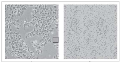 박테리아에 의한 세포 오염 시 현미경 관찰 그림