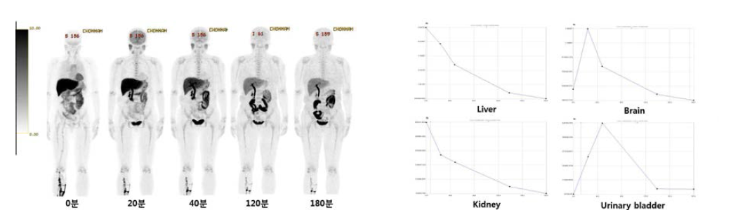 의생명연구자원자1의 PET 영상 및 시간-방사능 곡선