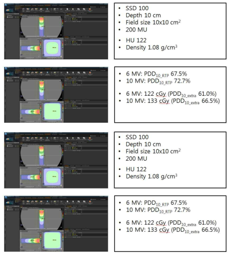 치료계획시스템에서 기준 조사야에서 200 MU 조사한 계산 결과