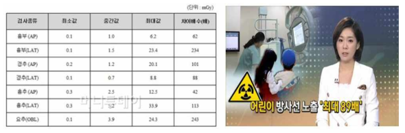 좌)의료기관별 검사 부위에 따른 방사선 노출량 (출처: 식품의약품안전처), (우)의료기관별 방사선 노출 차이의 심각성 관련 뉴스보도