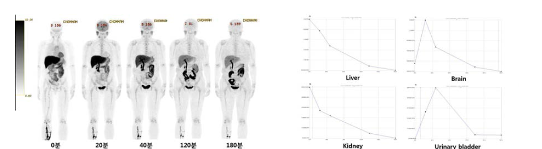 의생명연구자원자1의 PET 영상 및 시간-방사능 곡선