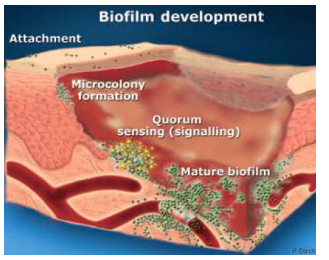 피부감염조직에서의 biofilm 형성과정