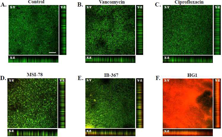 Three-dimensional images of MRSA biofilms after treatment with antibiotics and AMPs