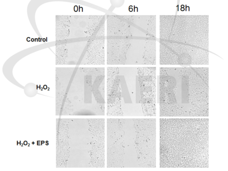 인간 HaCaT세포에 wound을 준 후에 H2O2을 처리하 거나 Deinococcus EPS와 H2O2를 동시에 처리하였을 경우 세포의 회복속도를 비교하였음