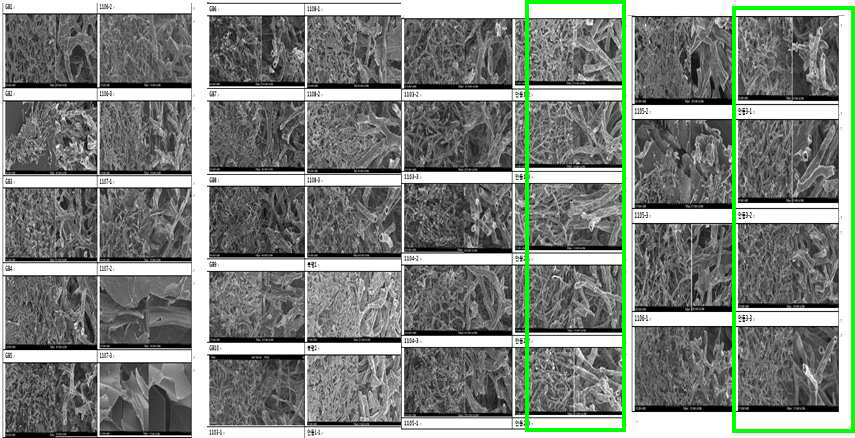 Comparison of electron microscopic fruiting bodies in various culture method