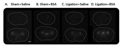 생쥐 brian의 2번째 3번째 절편조직(2mm) 의 ex vivo brain MMP cy5.5 image ; Sham+saline 에 비해 특정 signal 이 관찰되지 않음. (scale bar=1mm)