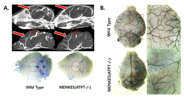 A.microfil 주입 한 MENKES 유전자 결핍 생쥐 뇌의 mCT 사진(A,위)과 적출된 뇌조직의 현미경사진(A,아래). B. 대뇌 피질의 혈관모양 차이를 india ink 주입 후 관찰한 사진