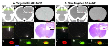 분자영상과 조직학 사이의 상관관계 : 표적 금나노입자 vs. 비표적 금나노입자 a. 2mm 두께로 재구성된 윌리스환 상의 혈전의 수평영상 b. a 에서 초록색으로 표시된 부분의 관상면(2mm 두께)에서 고음영으로 관찰되는 혈전영상, a´ 비표적 금나노입자를 이용한 mCT영상에서는 관찰되지 않음. c. 2mm 두께 뇌조직의 생체 외(ex-vivo) mCT 영상 d. 적출된 뇌의 생체 외 NIRF 형광영상. d'에서도 역시 관찰됨 e. 2mm 두께 뇌절편 관상면의 생체 외 혈전 형광영상. mCT 상에서 보이는 혈전 영상과 거의 일치함 f. c 에서 사용된 조직의 Hematoxylin-eosin 염색 영상 g. 뇌동맥 혈전의 Cy5.5 형광 현미경 사진 h. 같은 부분의 피브린 면역염색 및 Cy5.5-FITC 결합 영상 i. 혈전의 주요성분이 피브린 표적 금나노 입자의 대상인 피브린임을 보여줌