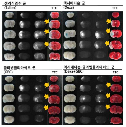 C57BL/6 생쥐 (그룹 당 n=35) 뇌절편 TTC 염색의 대표사진