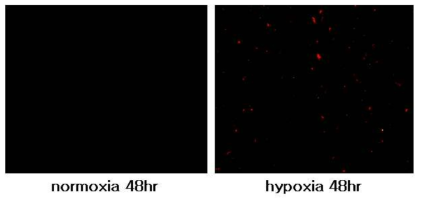 hypoxia 조건의 mouse MSC에서 관찰된 HIF-1α(Alexa Fluor 598)의 발현