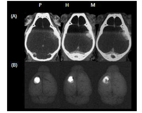 In vivo Micro CT(A), Ex vivo MMP-Cy5.5 activity(B) image