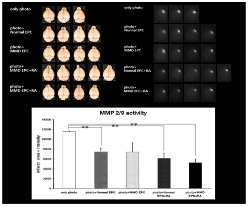 뇌경색 후 정상/MMD EPC 이식 또는 RA와 병행 처리한 마우스 뇌의 광학사진과 MMP 2/9 Cy5.5 NIRF 형광 사진 및 정량 분석한 그래프