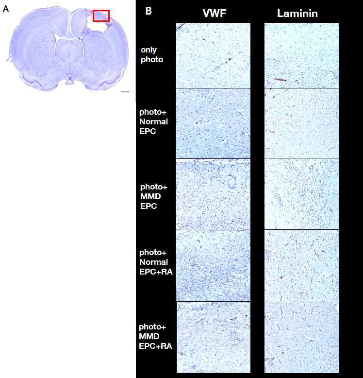실험 후 적출한 마우스 뇌조직 슬라이스의 H&E 염색사진 (A)과 VWF와 Laminin인자의 변역염색 사진 (B)