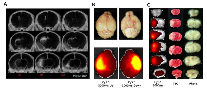 대뇌동맥 페색에 의한 뇌부종 생체분자영상