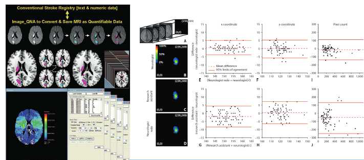 Quantitative brain mapping