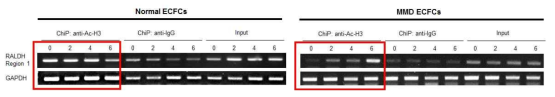 MMD ECFC에서 panobinostat의 처리에 의해 RALDH2 promotor acetylation이 증가됨