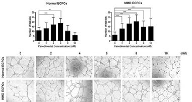 Panobinostat를 처리에 의해 MMD ECFC의 혈관 형성 능력이 향상됨