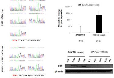 RNF213 variant가 있는 경우 p16 유전자와 단백질 발현이 높은 것을 확인함