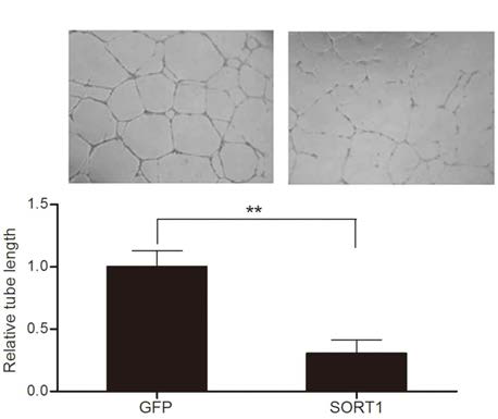 SORT1 유전자의 과발현으로 인한 혈관형성 저해