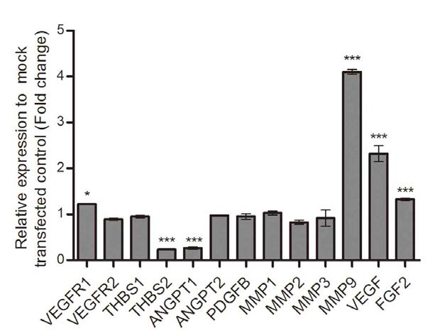 SORT1 유전자의 과발현으로 인한 주요 angiogenic factor와 matrix metalloproteinase의 발현 변화