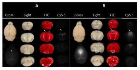 뇌정맥동-혈전을 일으킨 생쥐 전뇌를 위에서 본 전체사진(A TTC 염색; NIRF-Cy5.5 영상). A는 rose bengal만 주입하고 광조사를 하지 않은 경우이고 B는 rose bengal주입 후 광조사를 함께 실행한 경우임