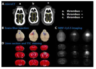 뇌정맥동 모델에서 Evans Blue의 BBB (혈관-뇌장벽)누출을 확인한 대표사진