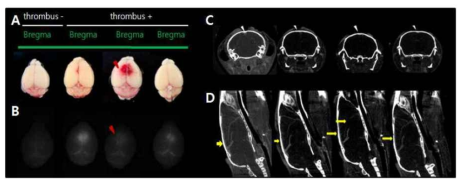 뇌정맥동-혈전증 분자영상에 적합한 AuNP 스크리닝: Glycol chitosan AuNP A, 혈전을 유발(-/+)한 뒤 생쥐 전뇌의 gross사진; B는 생쥐 전뇌를 NIRF-Cy5.5 channel 필터에서 영상화한 사진; in vivo microCT 영상 캡쳐사진(C, 정면; D, 측면)