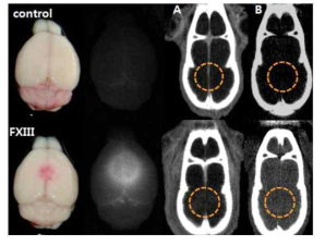 뇌정맥동-혈전증 분자영상에 적합한 AuNP 스크리닝: Coagulation factor XIII-sensing AuNP