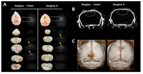 혈전 위치(bregma와 bregma +4mm)에 따른 Ultravist leakage area 비교 A,뇌정맥동-혈전을 유발한 생쥐와 대조군 모델 생쥐의 gross와 Cy5.5사진;B, MicroCT로 생쥐전뇌를 scanning한 캡쳐사진;C, in vivo microCT 3D 영상