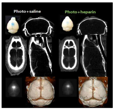 microCT기반 혈관조영 + 혈전 / BBB 분자영상기술을 이용한 생쥐 뇌정맥동-혈전증 치료법 개발 준비 연구- heparin pretreatment + 광조사 48시간 후 대조군(PBS주입, n=6)과 heparin 처리군(n=6)과의 비교