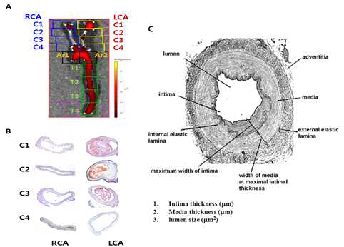 A, 고지 방식이 ApoE-/-mice에서 left common carotid artery (LCA)의 ligation부위와 주변부에서 matrix metalloproteinase(MMP)-2/9의 NIRF signal 강도를 보여주는 그림(pseudo - color overlaid, intensity expressed as arbitrary unit)