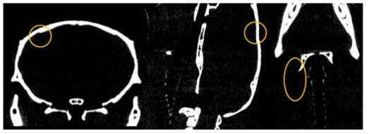 대뇌동맥과 carotid에 혈전증을 유발한 뒤 Fibrin AuNP 주입하여 촬영한 microCT 영상