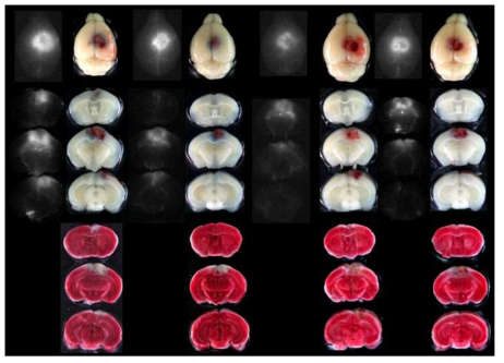 생쥐에 1시간 광조사하여 뇌정맥동 혈전증을 유발한 후 희생시킨 쥐의 전뇌와 절편의 NIRF cy5.5 형광, Light 사진