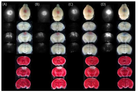생쥐에 40분 광조사하여 뇌정맥동 혈전증을 유발한 후 희생시킨 쥐의 전뇌와 절편의 NIRF cy5.5 형광, Light 사진